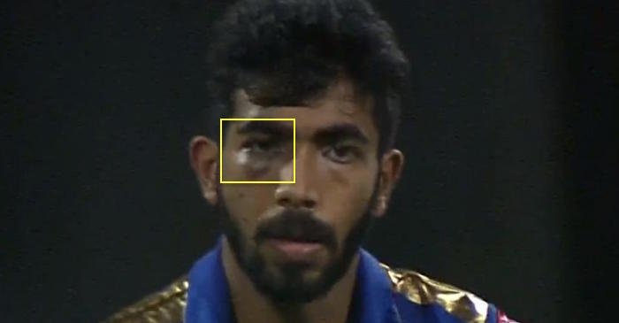 IPL 2019: MI coach Mahela Jayawardene reveals the reason behind Jasprit Bumrah’s swollen eye