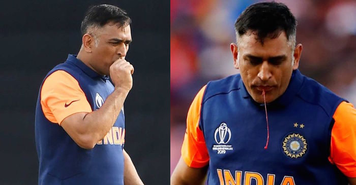 World Cup 2019: Team India official gives an update on MS Dhoni’s thumb injury